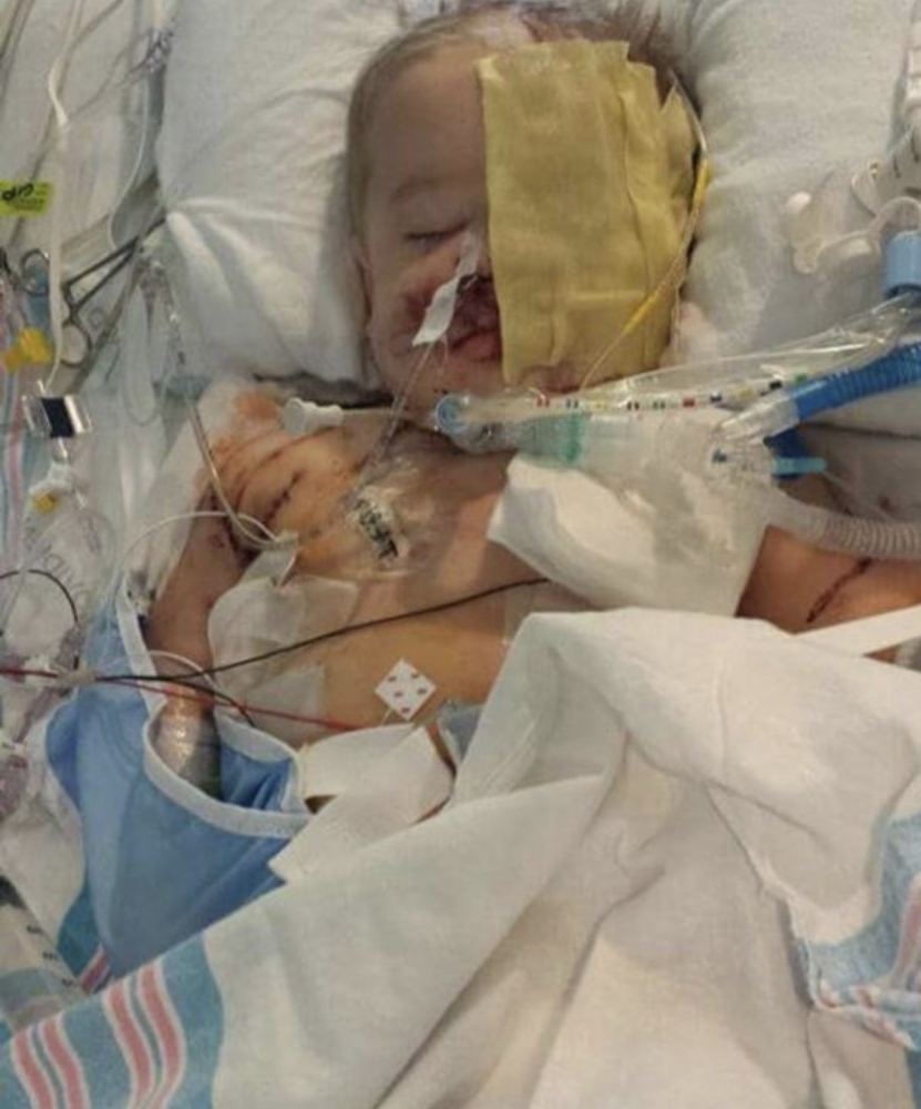 莱德·韦尔斯|美国小男孩被猎犬咬掉半张脸，如今长大被称为怪物