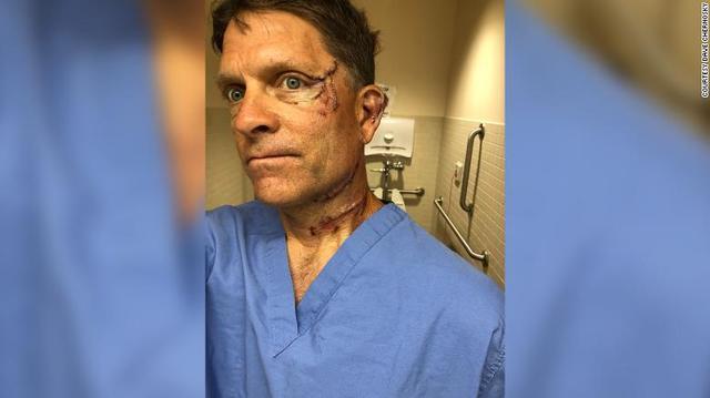 切尔诺斯基|黑熊闯进家中，美国男子为救孩子拼死搏斗：它给我一拳，又把我转了个圈
