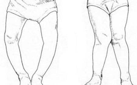 紫外线|黑色吸热，非洲那么热为何会进化出黑皮肤？科学家：命更重要