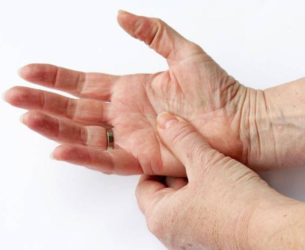 类风湿性关节炎|起床后手指僵硬、合不拢，别忽视，可能与这3种疾病有关