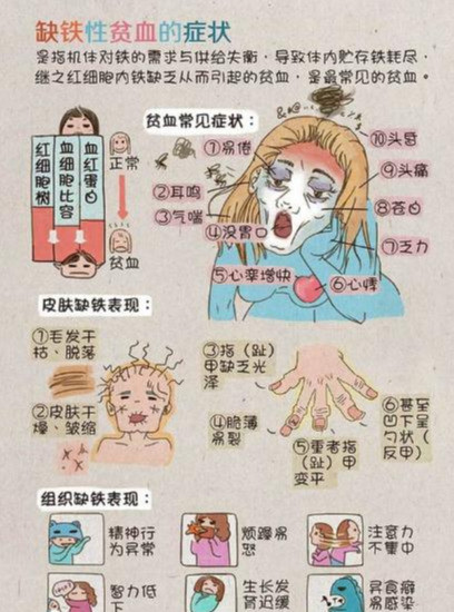 缺铁的表现 腾讯网