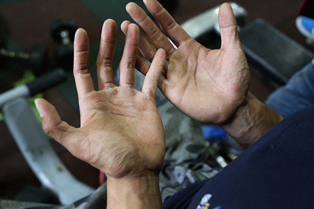 拉单杠磨得手疼简单几个技巧让你轻松应对