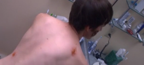 头皮发麻|看到隐藏在人体内的虫子，我感受到了头皮发麻