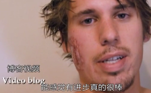 头皮发麻|看到隐藏在人体内的虫子，我感受到了头皮发麻