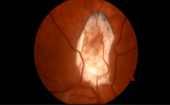 头皮发麻|看到隐藏在人体内的虫子，我感受到了头皮发麻