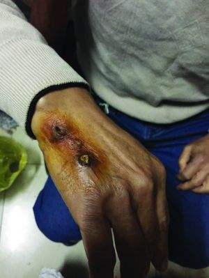 咬人形成常态的狗子如何处理为妥