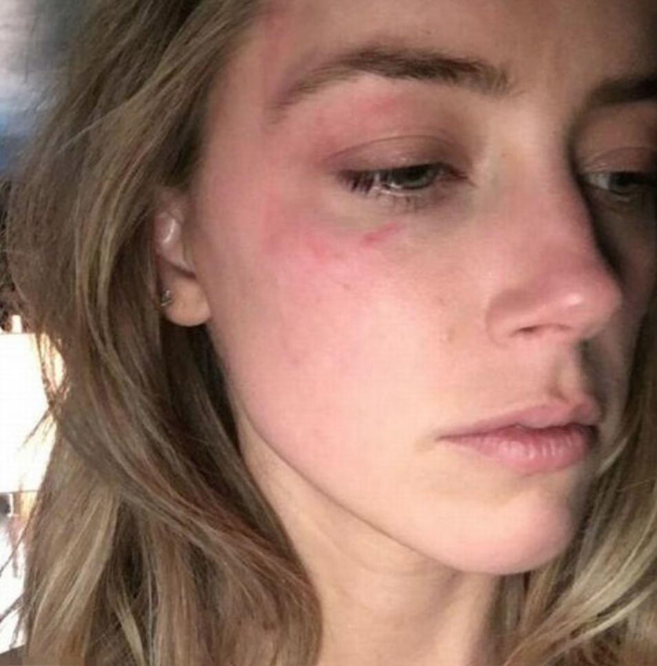 艾梅柏·希尔德|家暴、出轨、吸毒，真没想到，他俩离婚三年后剧情还能反转！