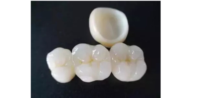 装过烤瓷牙还能做牙齿矫正吗