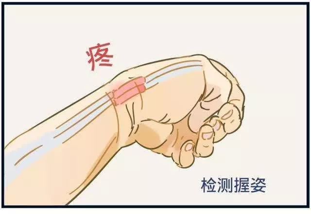 长时间玩手机的都来看看扳机指腱鞘炎