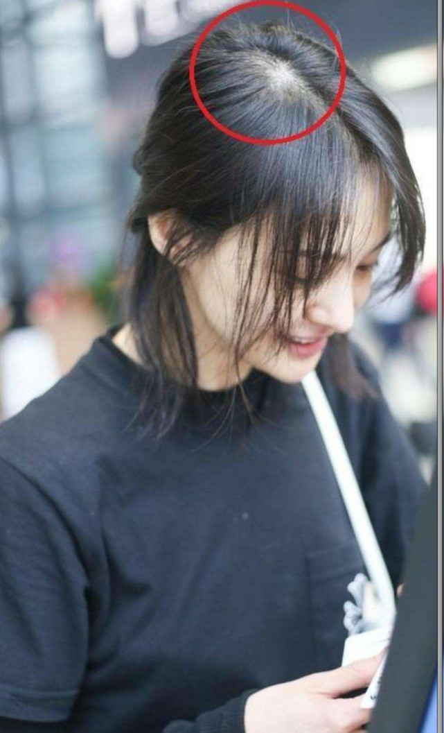 郑爽综艺中无意露出假发片,自爆秃头后却获网友称赞!