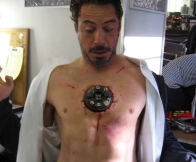 钢铁侠胸部的心脏并非特效那是怎么放进身体的