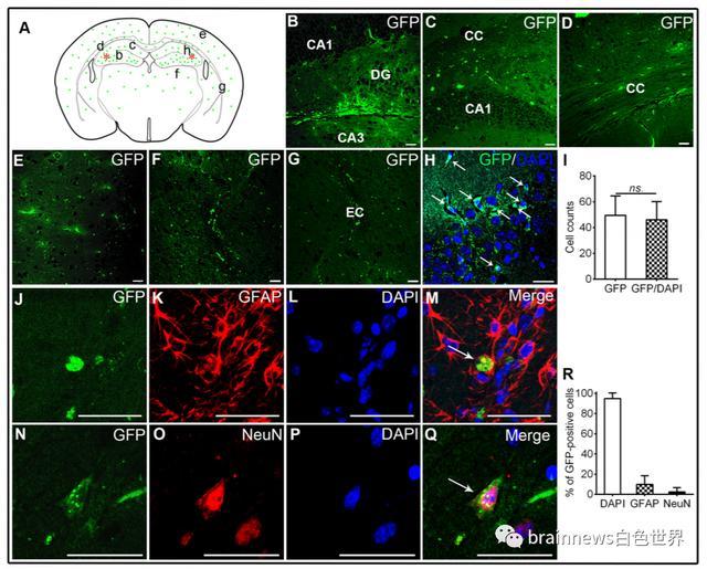 神经干细胞移植|人类神经干细胞移植可改善AD认知缺陷