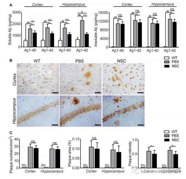 神经干细胞移植|人类神经干细胞移植可改善AD认知缺陷