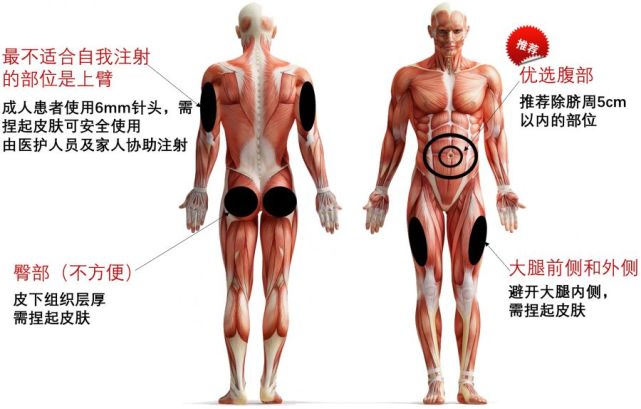 大腿肌肉注射部位图片