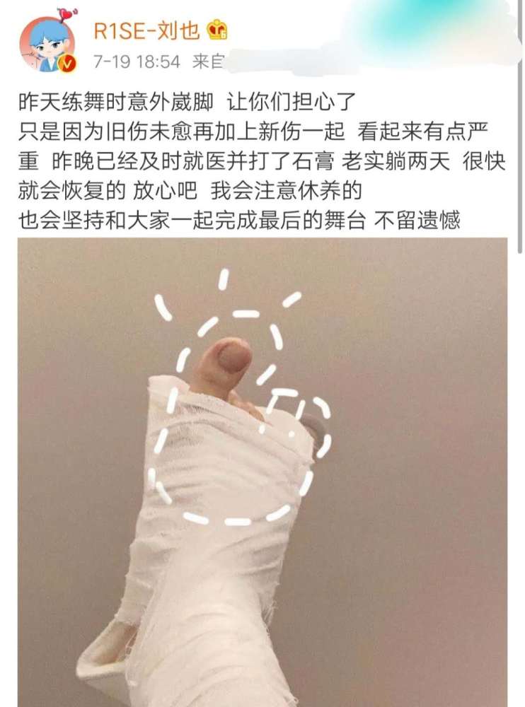刘也|R1SE刘也练舞意外崴脚，打石膏向粉丝报平安，还不忘卖萌