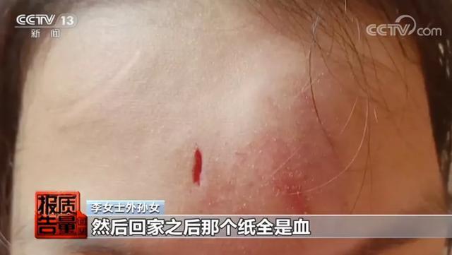 马路杀手|“网红代步神器”竟是“马路杀手” 你家说不定也有！