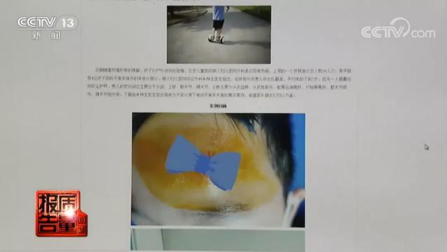 马路杀手|“网红代步神器”竟是“马路杀手” 你家说不定也有！