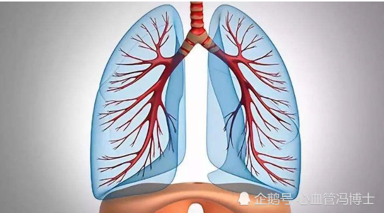 胸痛小心是由於肺動脈血栓栓塞導致