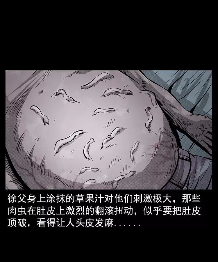 男子肚子像十月怀胎孕妇般肚皮下竟有虫状物蠕动赤脚医生破蛊