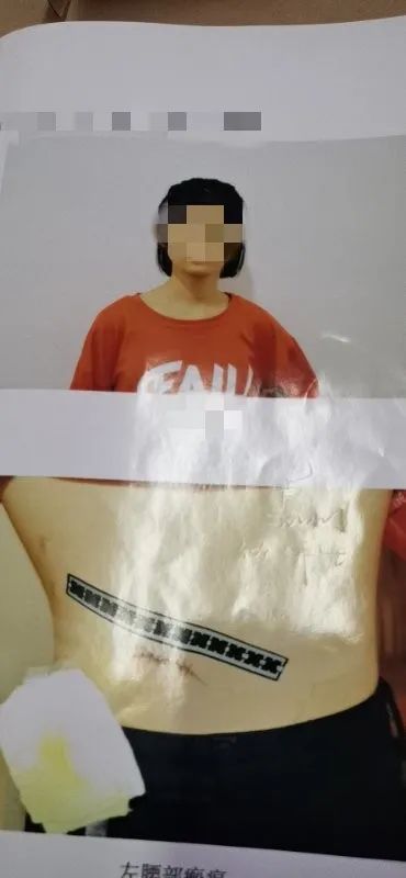 走在外侧的女生曾某,突然被一名骑电动车的黑衣男子持刀刺中腰部.