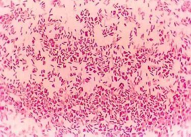 认识水产品的副溶血性弧菌