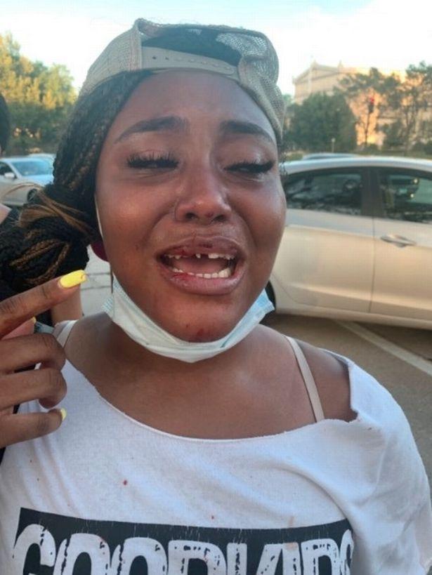 警察|美国警方暴力升级！18岁黑人少女抗议被狠揍，牙掉一地哭喊求救