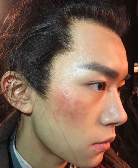 易烊千玺怼脸素颜照,浓眉大眼高鼻梁惹人注目,脸上的伤都异常好看|易