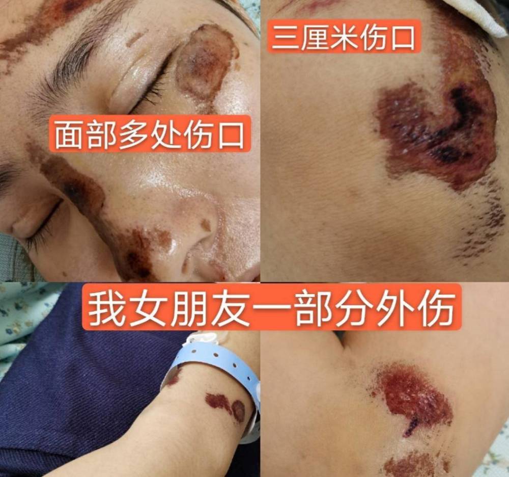 网红|白岩松评网红大闹医院，姜涛卖惨称想跳楼解脱，认个错咋就这么难