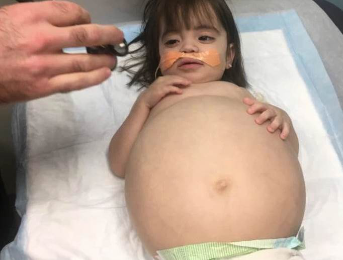 Une Petite Fille De 2 Ans Au Gros Ventre A L Air Enceinte Daynewsfr