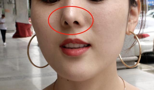 "鼻毛都能看见!"女主播花十几万整容翻车,医院:你要求太高了