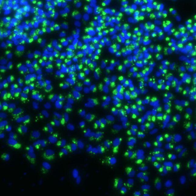 新冠肺炎|将新冠肺炎变为一场“普通感冒” 这款常规药物能成为抗疫关键吗？