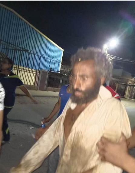 穆罕默德·埃尔·加玛尔|被埋4个月后，埃及男子从墓地爬出奇迹复活，医生：这就是奇迹