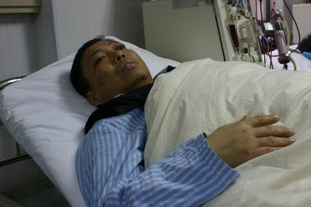 尿毒症是什么病如何才能治好尿毒症医生说的明明白白