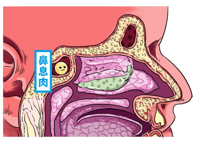 鼻息肉九叔这就带大家认识他们最后带来可怕后果努力让自己癌变聪明的