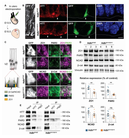 脑成像|脑科学日报：运动员脑成像研究发现与意志品质相关的大脑结构组织
