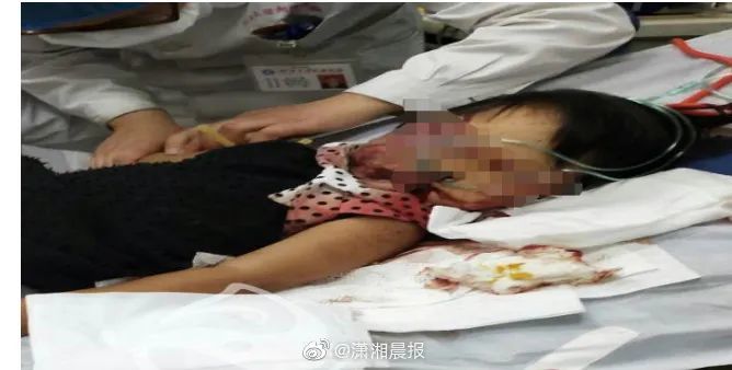 男子持铁锹当街暴打老人小孩-WordPress极简博客