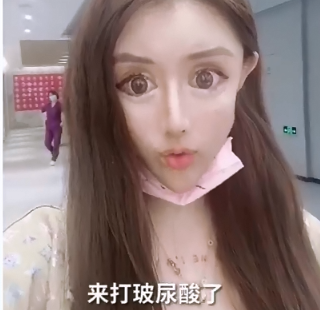 整容|13岁就开始整容的女网红出现后遗症！医生称嘴巴缝太多无法修复