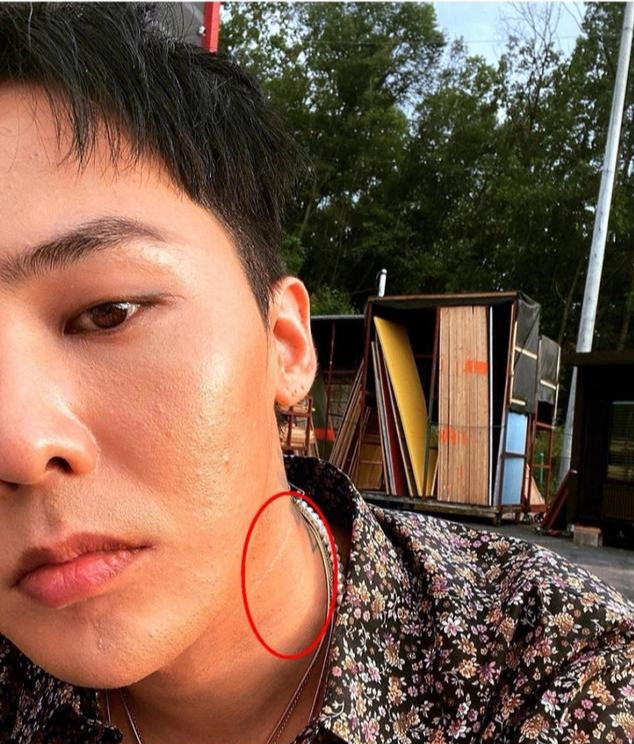 权志龙晒无p自拍,青春美丽疙瘩痘太多,脖子太热已脱粉