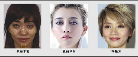 整容|整容10余次变“梅艳芳”，疯狂捞金月入超10万，刘德华见她都泪奔