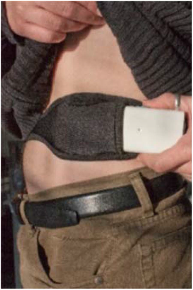 帕金森病|穿戴式传感设备在帕金森病评定中的应用