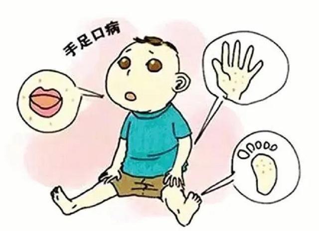 儿童|炎炎夏日，儿童容易被这4种病传染，当爹妈的一定要警惕