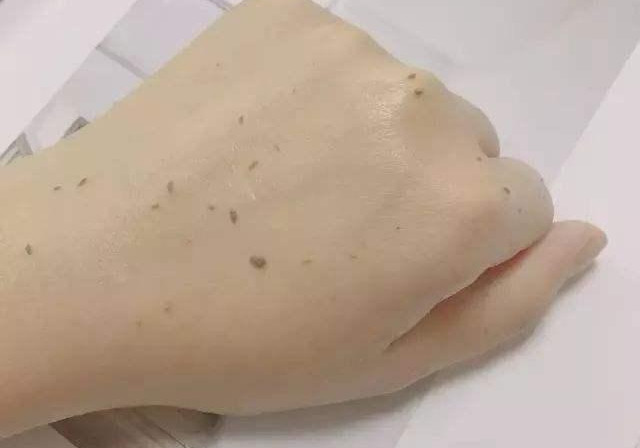 鸡皮肤用海绵可以刷吗(鸡皮肤用海绵可以刷吗女生)