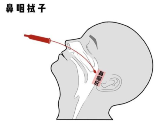 核酸检测|咽拭子刮喉痛不痛？采样后如何转运、检测？独家揭秘核酸检测那些事！