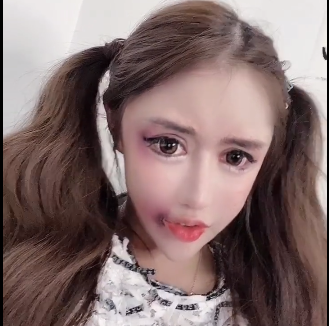 13岁就开始整容的女网红遇到大麻烦!玻尿酸和假体被打出来了