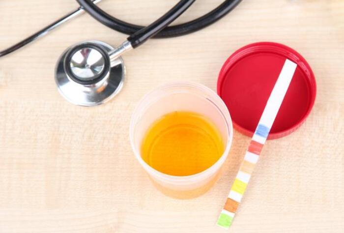 尿毒症|4类长效降蛋白药，还是防治尿毒症“利器”，适合大多数肾友