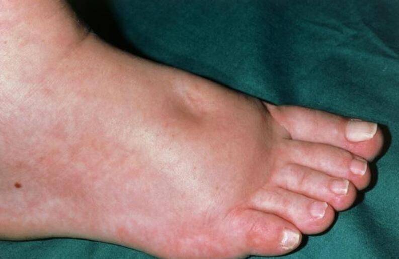 肾内科|你以为这些都是“小毛病”，肾内科医生提醒：小心是肾衰竭