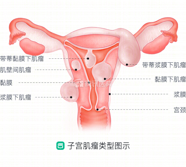 人体子宫位置图解图片