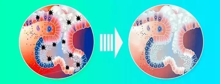 爱用手抠鼻子 耳鼻喉科提醒 小心鼻前庭炎 腾讯新闻