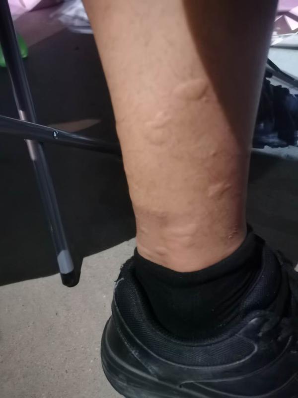 心疼全身蚊子包脚磨烂受郑州增援信阳部分消防员昨晚抵郑回防郑州