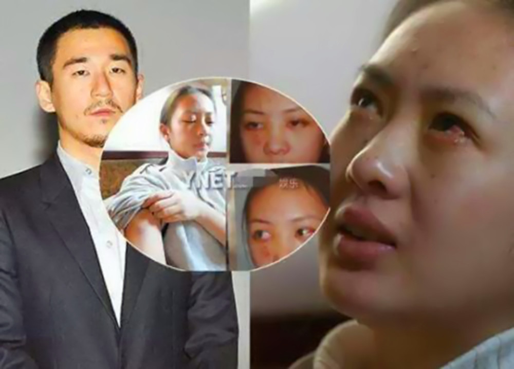 曾经甘愿接受规则的童瑶被男友张默殴打为何如今完美翻身